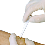 Acu Punch 8mm Biopsy Punches - Box of 10