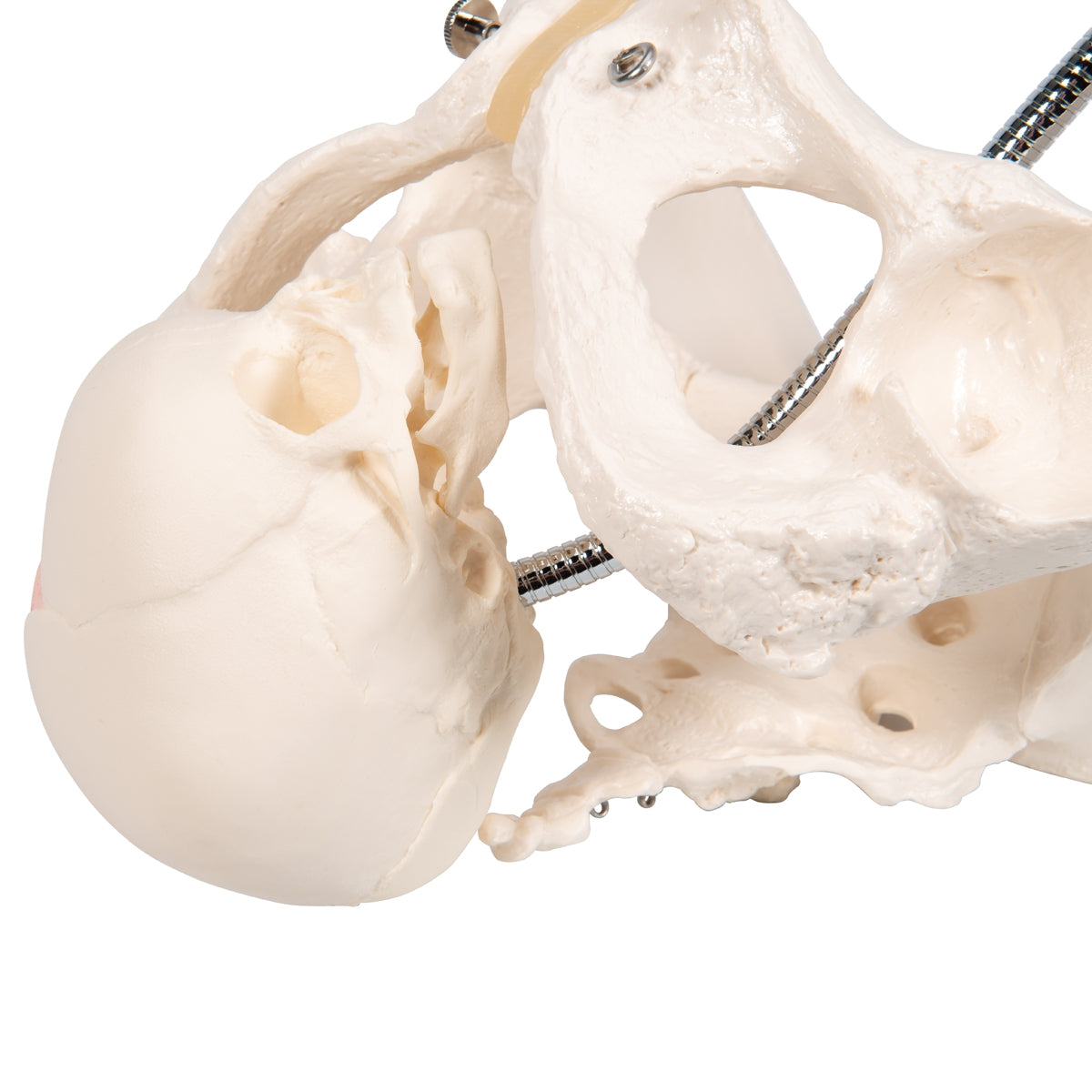 Childbirth Demonstration Pelvis Skeleton Model with Fetal Skull