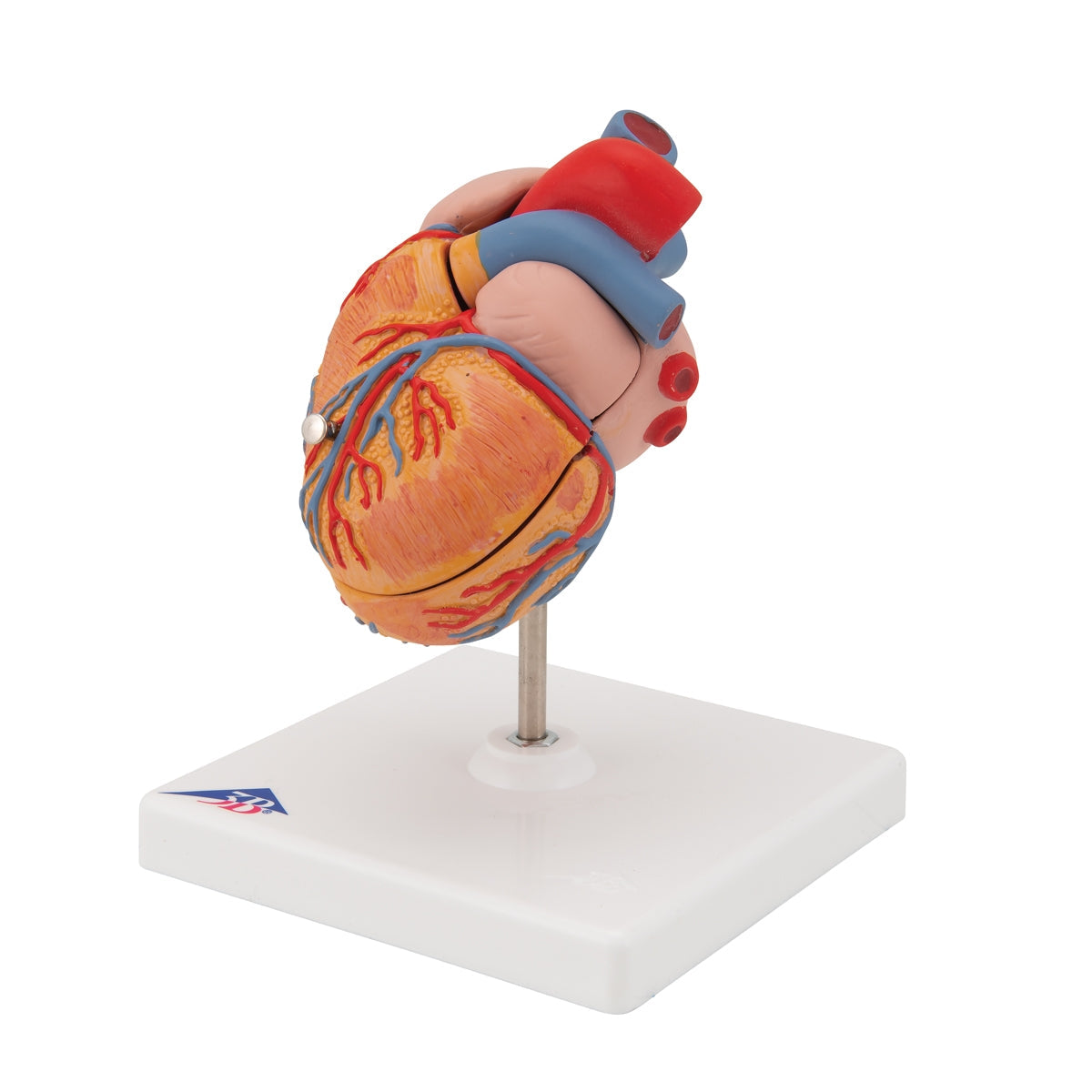 Classic Human Heart Model with Left Ventricular Hypertrophy (LVH), 2 part