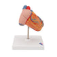 Classic Human Heart Model with Left Ventricular Hypertrophy (LVH), 2 part