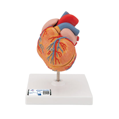 Classic Human Heart Model with Left Ventricular Hypertrophy (LVH), 2 part