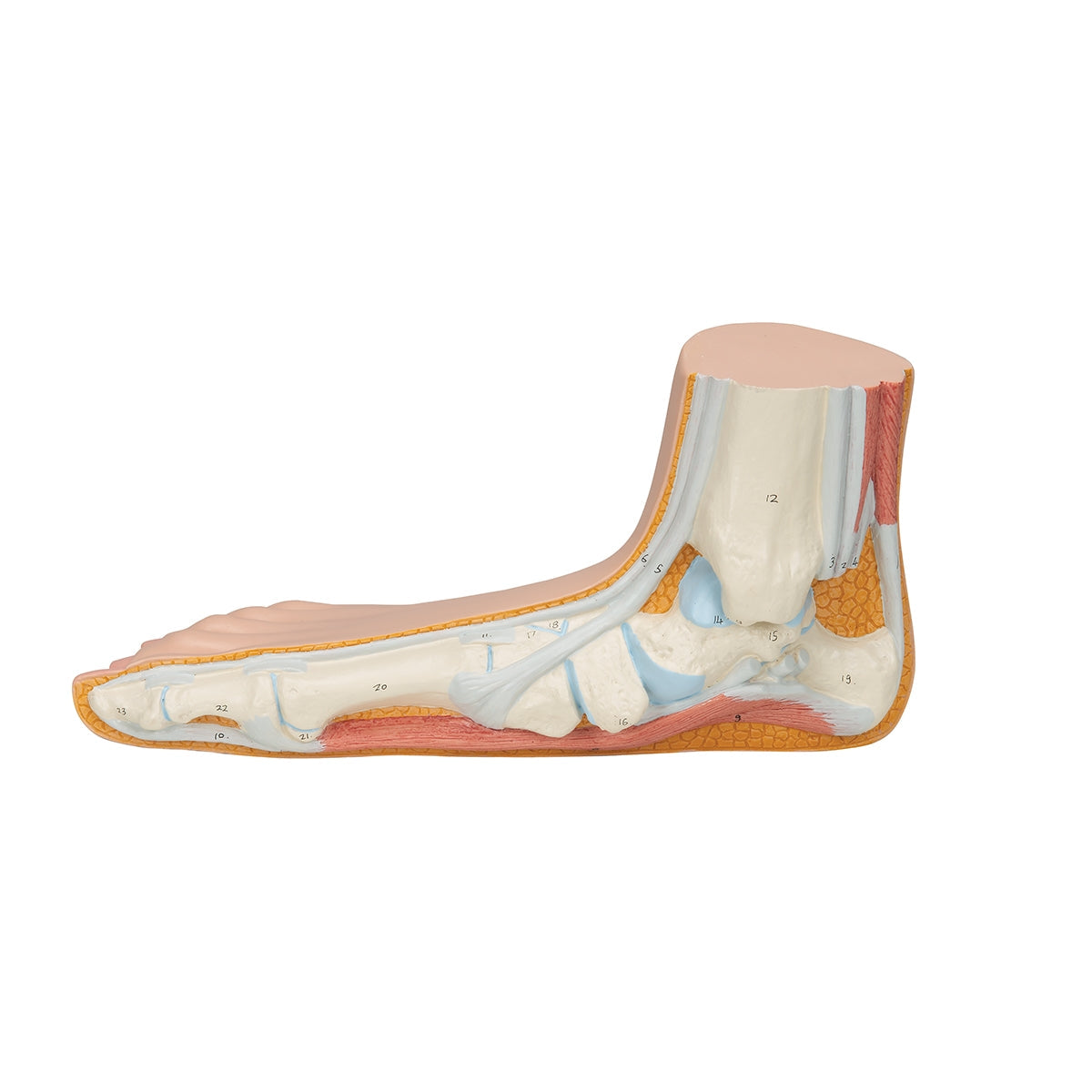 Flat Foot (Pes Planus) Model