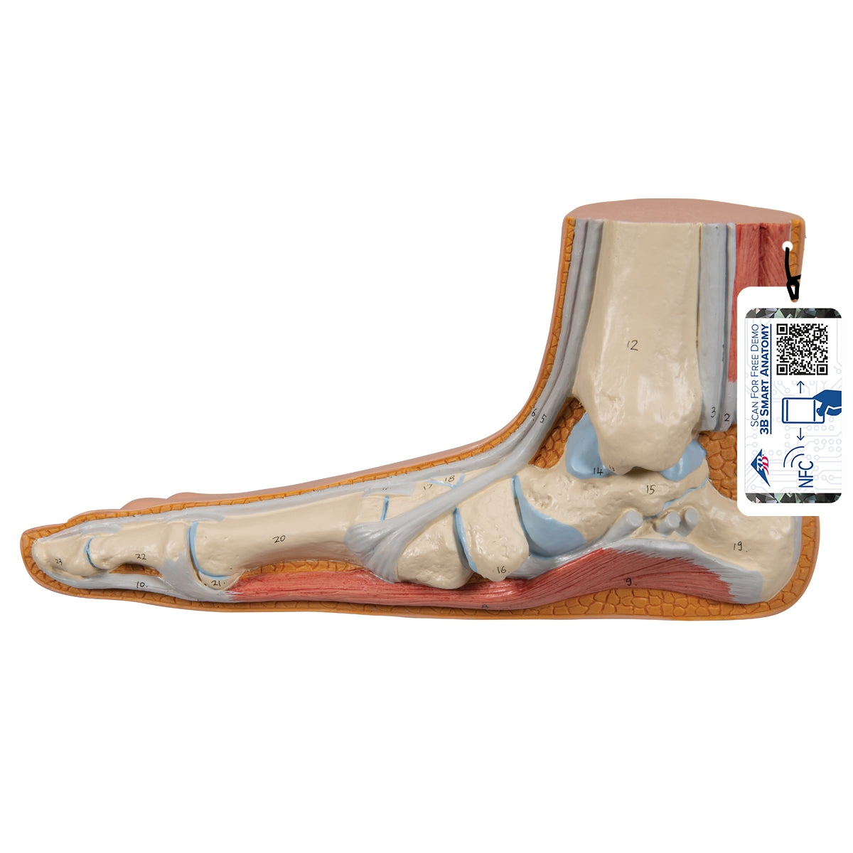 Flat Foot (Pes Planus) Model