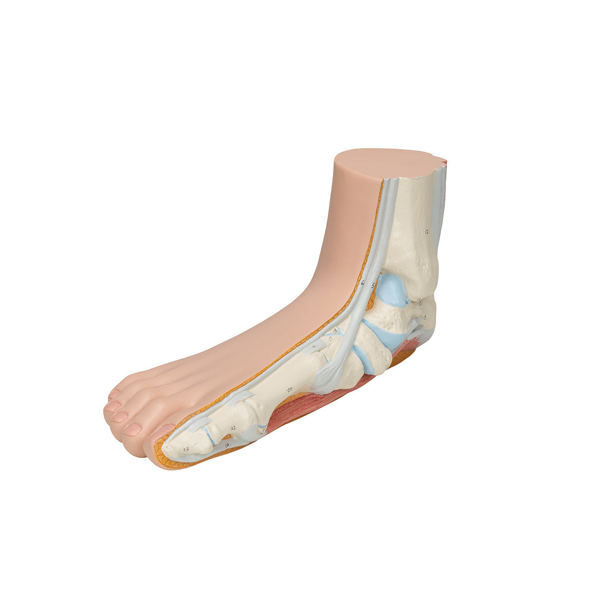 Flat Foot (Pes Planus) Model