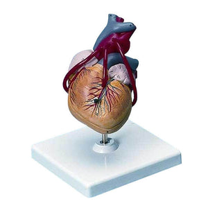 Heart Model with Bypass