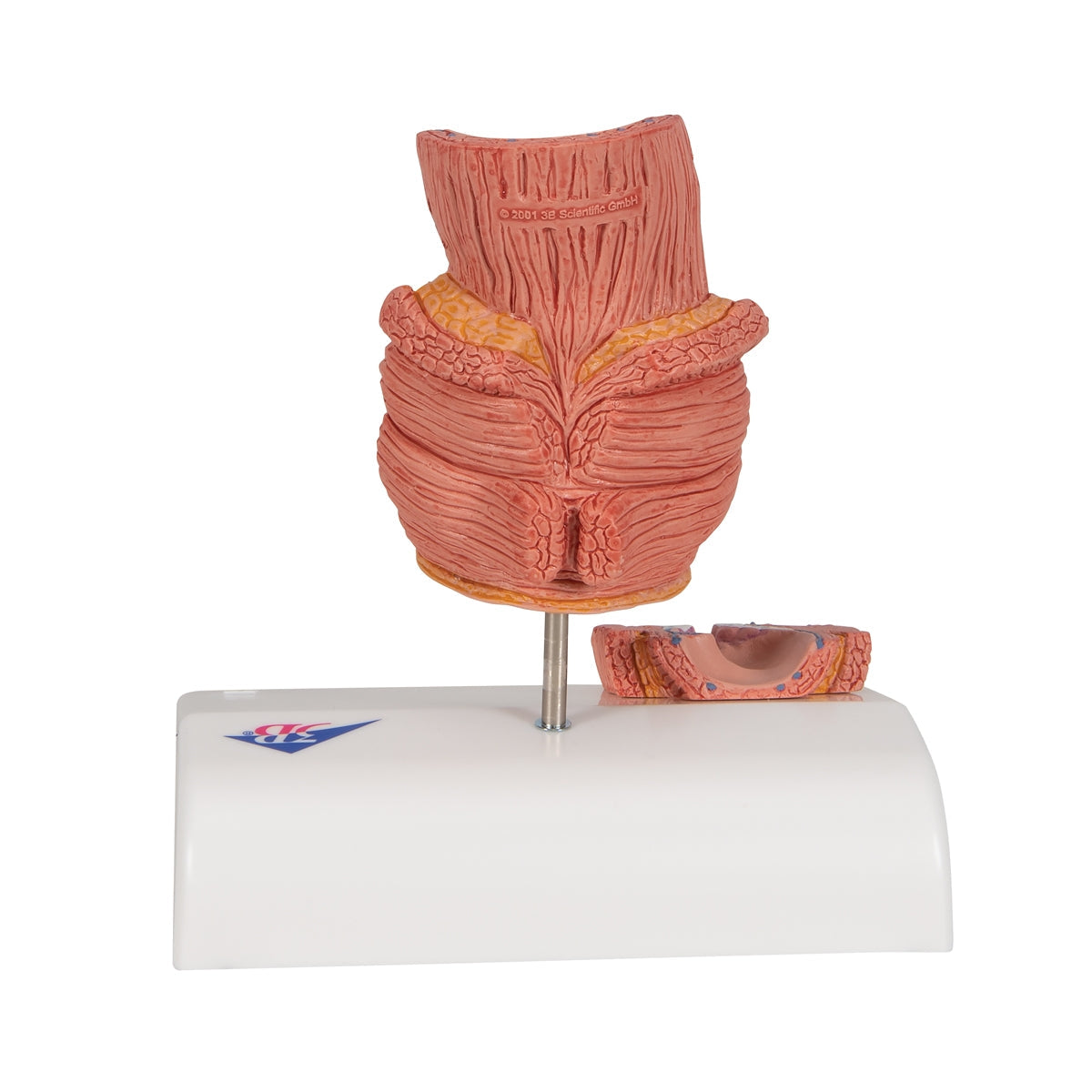 Hemorrhoid Model