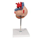 Human Heart Model, 2-times Life-Size, 4 part