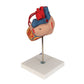 Human Heart Model with Bypass, 2 times Life-Size, 4 part