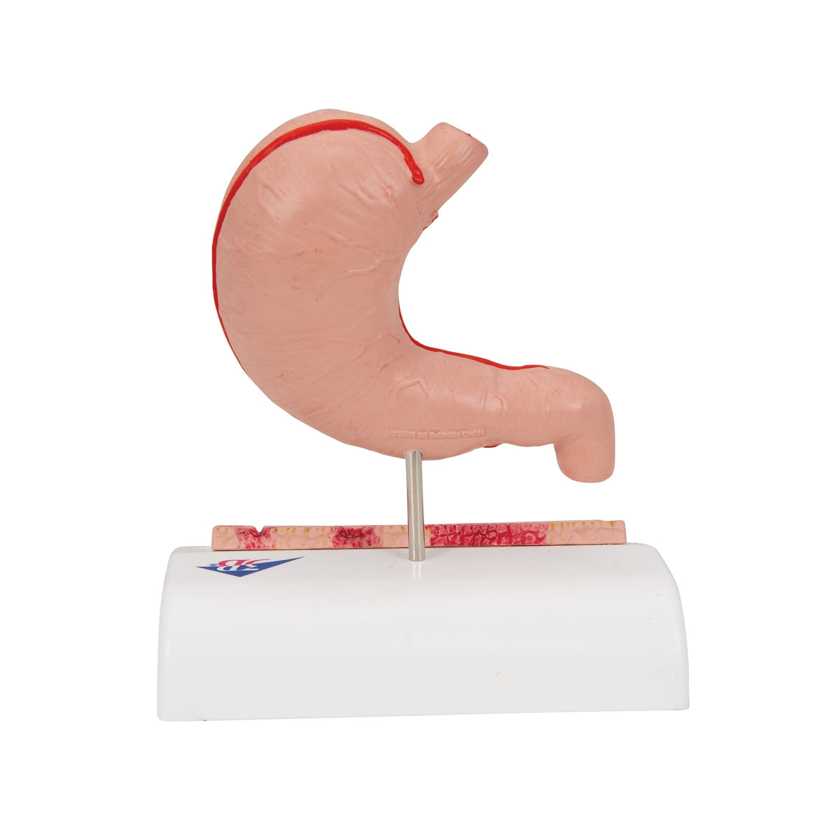 Human Stomach Section Model with Ulcers