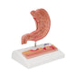 Human Stomach Section Model with Ulcers