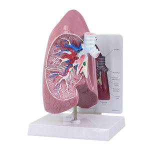 Lung Model