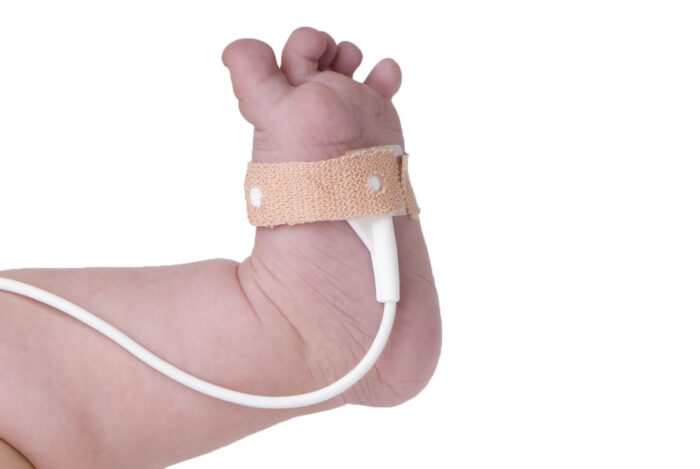 Neonatal Wrap Sensor