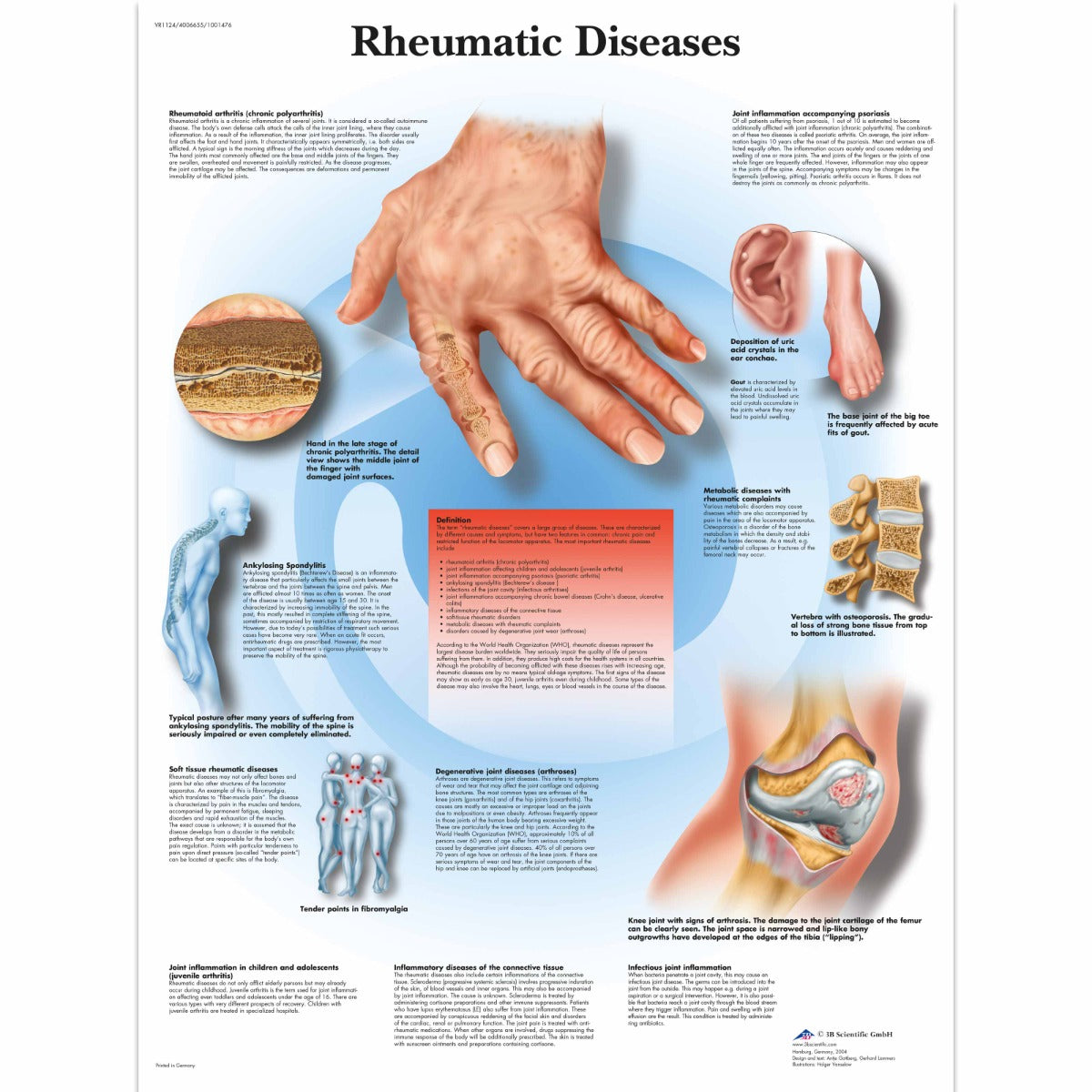 Rheumatic Diseases Chart