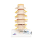Stages of Disc Prolapse and Vertebral Degeneration