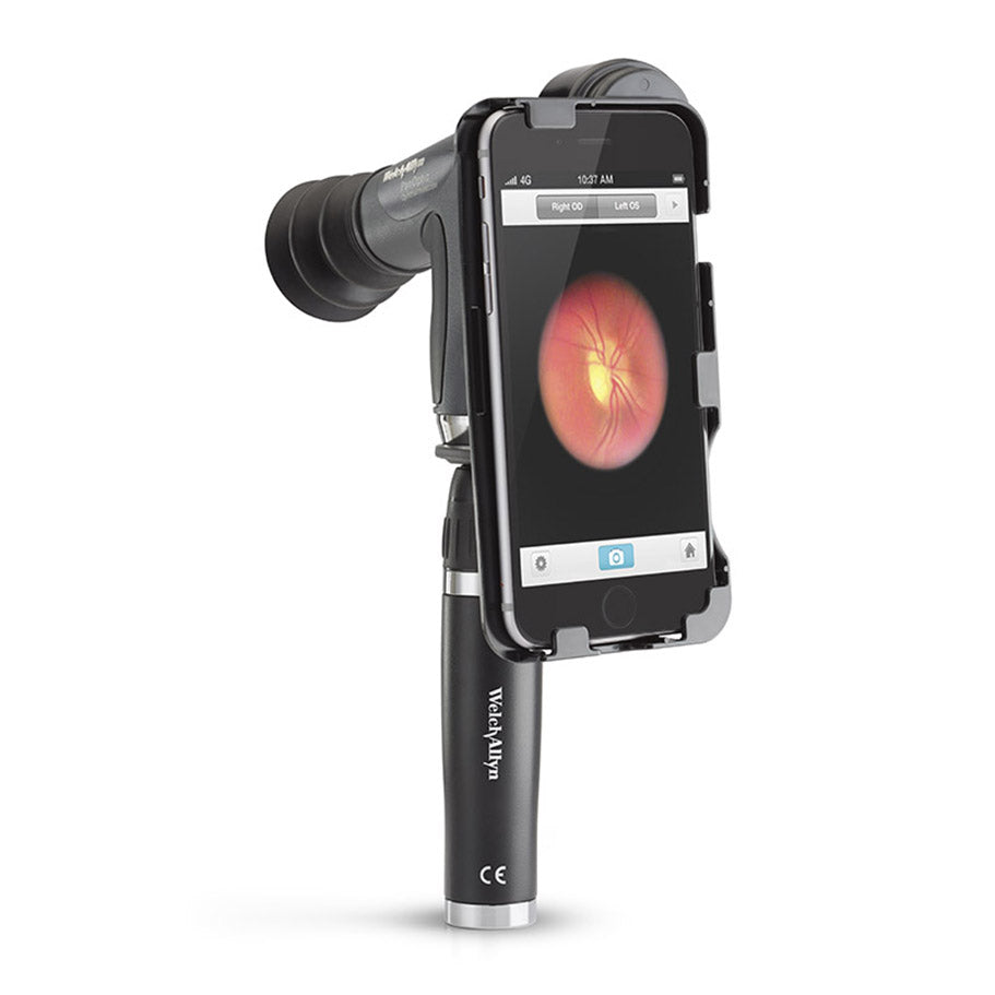 Welch Allyn iExaminer Adaptor for the iPhone 6 and 6S