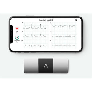 AliveCor KardiaMobile ECG 6 Lead