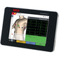 seca CardioPad-2 Touch Screen 12 Lead ECG With Wi-Fi & Advanced Interpretation